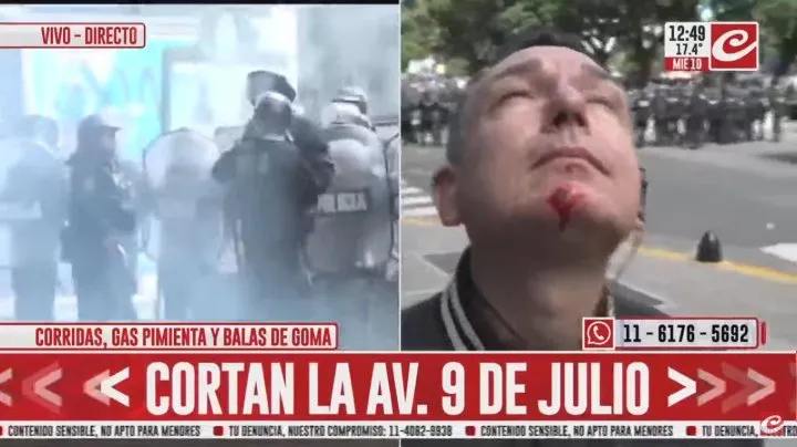 periodistadecronicaherido-a3fc5